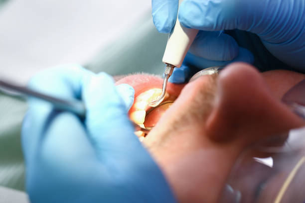 Best Pediatric Emergency Dentist in Decordova, TX