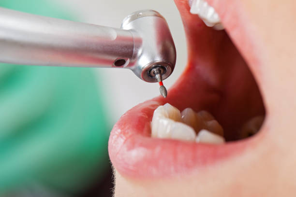 Best Orthodontic Emergency Dentist in Decordova, TX